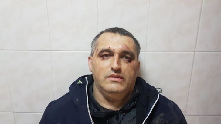 У Чернівцях побили активіста «Стоп корупції». Подробиці інциденту